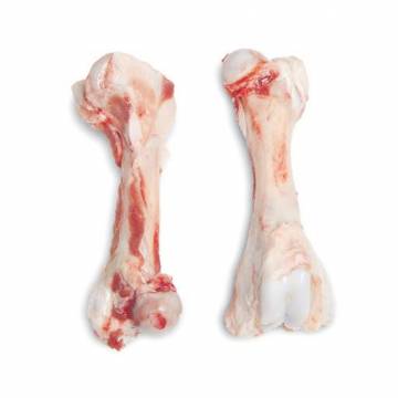 Femur Bone